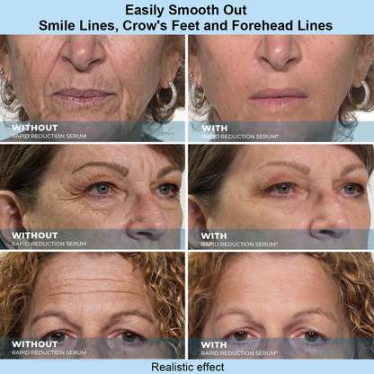 poutpopshop™ Instant Face Temporary Tightener – Instant visible results in 60 seconds