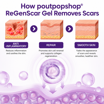 POUTPOPSHOP™ ReGenScar Stem Cell Scar Gel