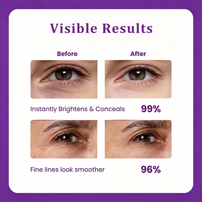 poutpopshop™Korean Calcium Dark Spot Eye Cream | Dark Circle, Anti-aging, Sagging, Elasticity |