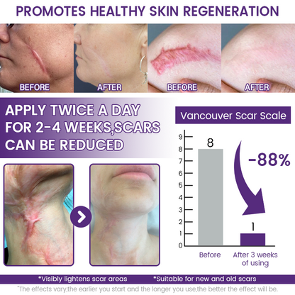 POUTPOPSHOP™ ReGenScar Stem Cell Scar Gel