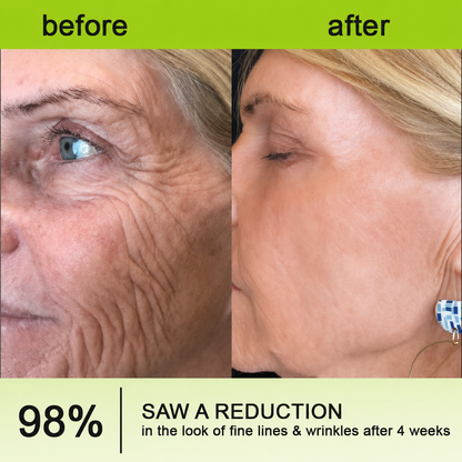 POUTPOPSHOP™ peptide-powered & Vita-A Retinol Shot Wrinkle-Lift Tightening cream - Last Day Promotion 70% OFF