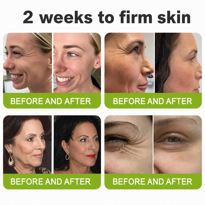 POUTPOPSHOP™ peptide-powered & Vita-A Retinol Shot Wrinkle-Lift Tightening cream - Last Day Promotion 70% OFF