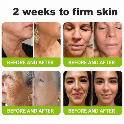 POUTPOPSHOP™ peptide-powered & Vita-A Retinol Shot Wrinkle-Lift Tightening cream - Last Day Promotion 70% OFF