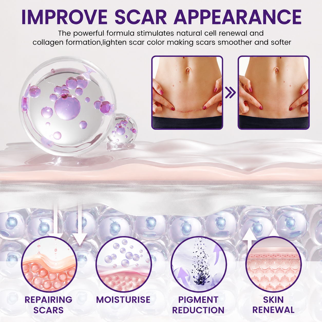 POUTPOPSHOP™ ReGenScar Stem Cell Scar Gel